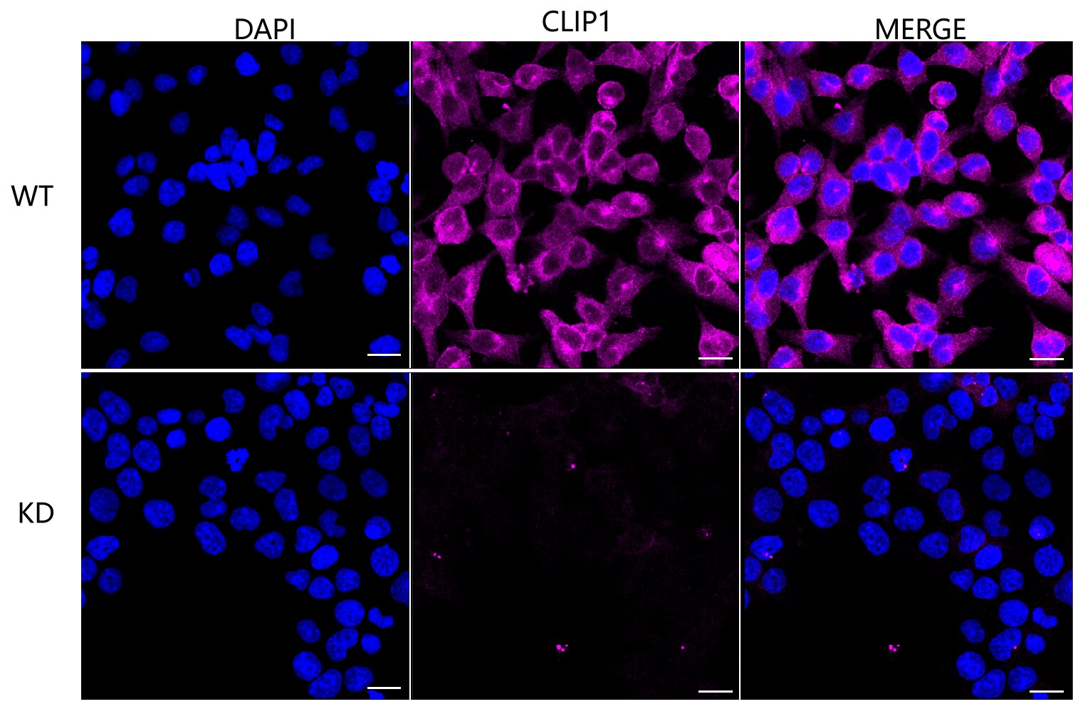 CLIP170 Antibody (23GB3080)