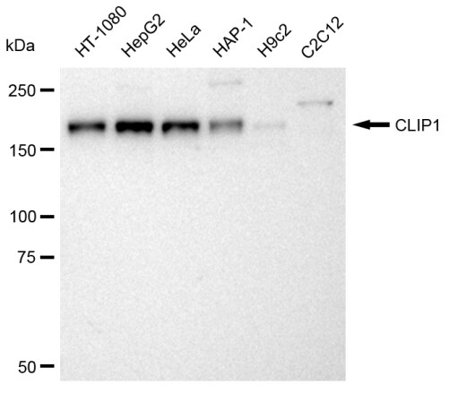 CLIP170 Antibody (23GB3080)