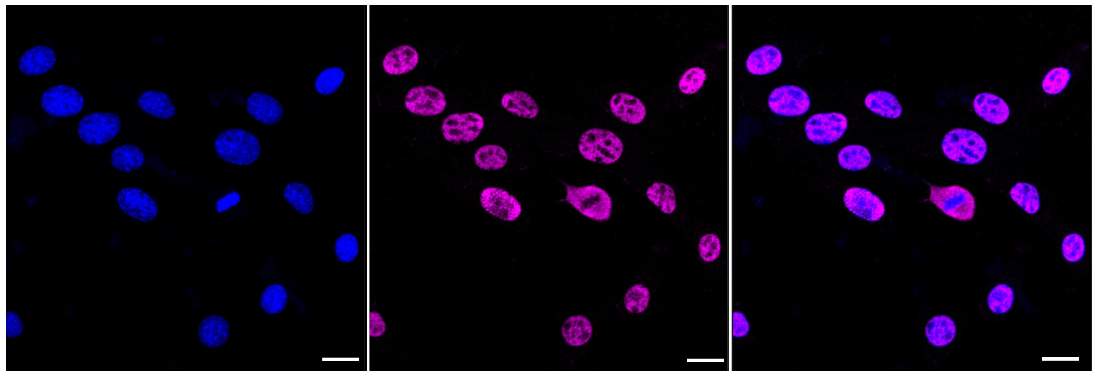 AKAP95/AKAP8 Antibody (23GB2970)