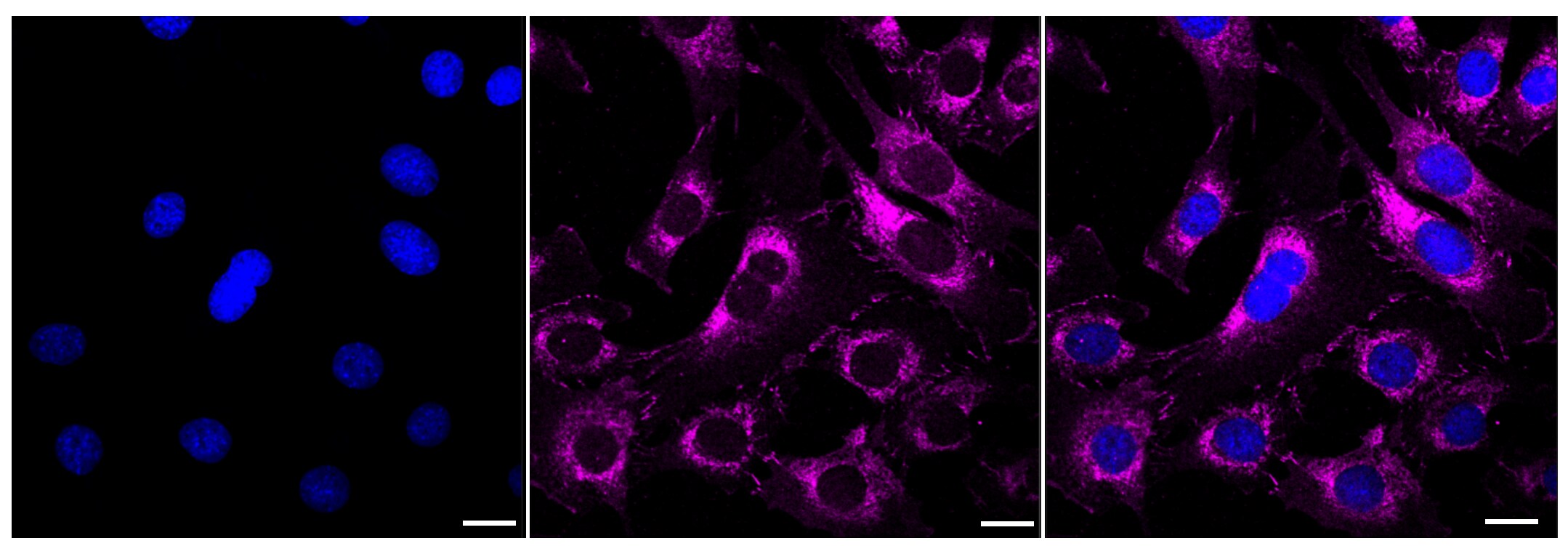 p120-catenin Antibody (23GB3025)