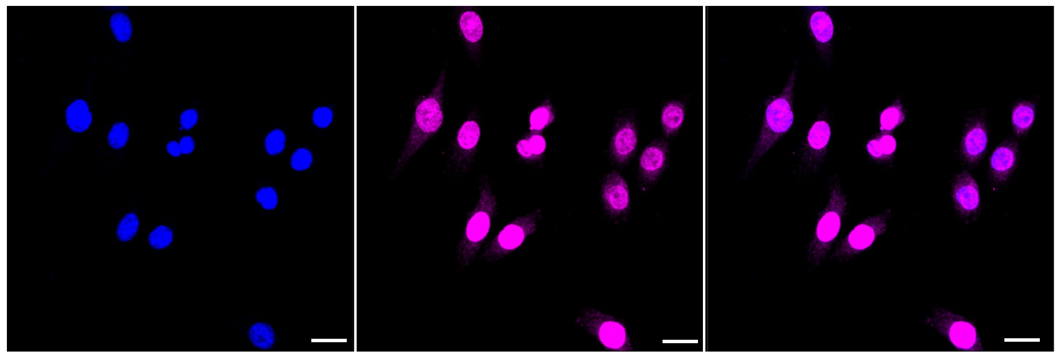 BIN1 Antibody (23GB3265)