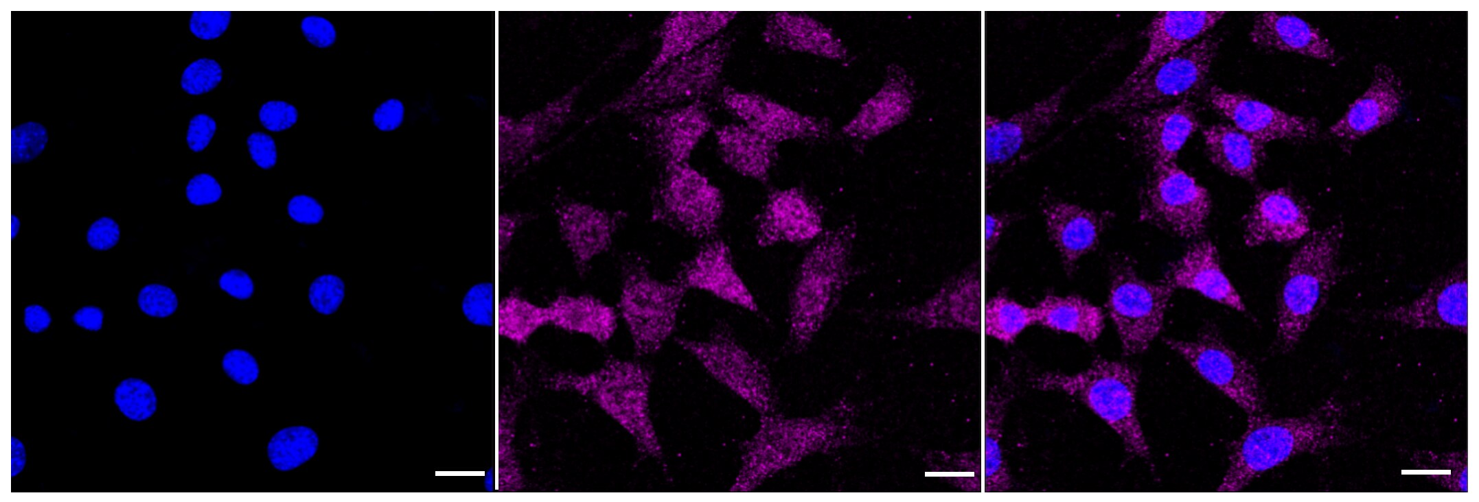 Androgen R/NR3C4 Antibody (23GB3210)