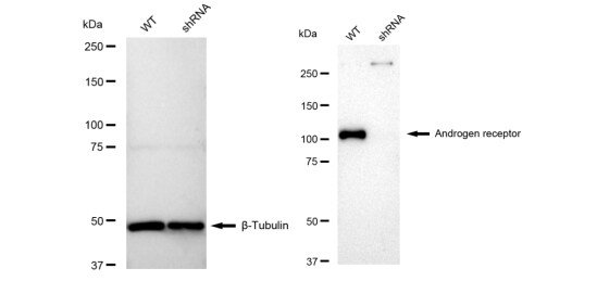 Androgen R/NR3C4 Antibody (23GB3210)