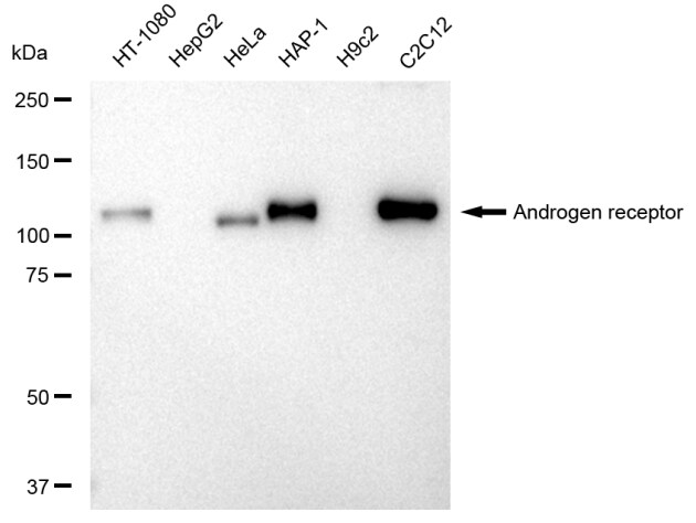 Androgen R/NR3C4 Antibody (23GB3210)