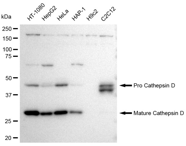 Cathepsin D Antibody (23GB3340)