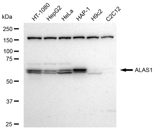 Alas1 Antibody (23GB3190)
