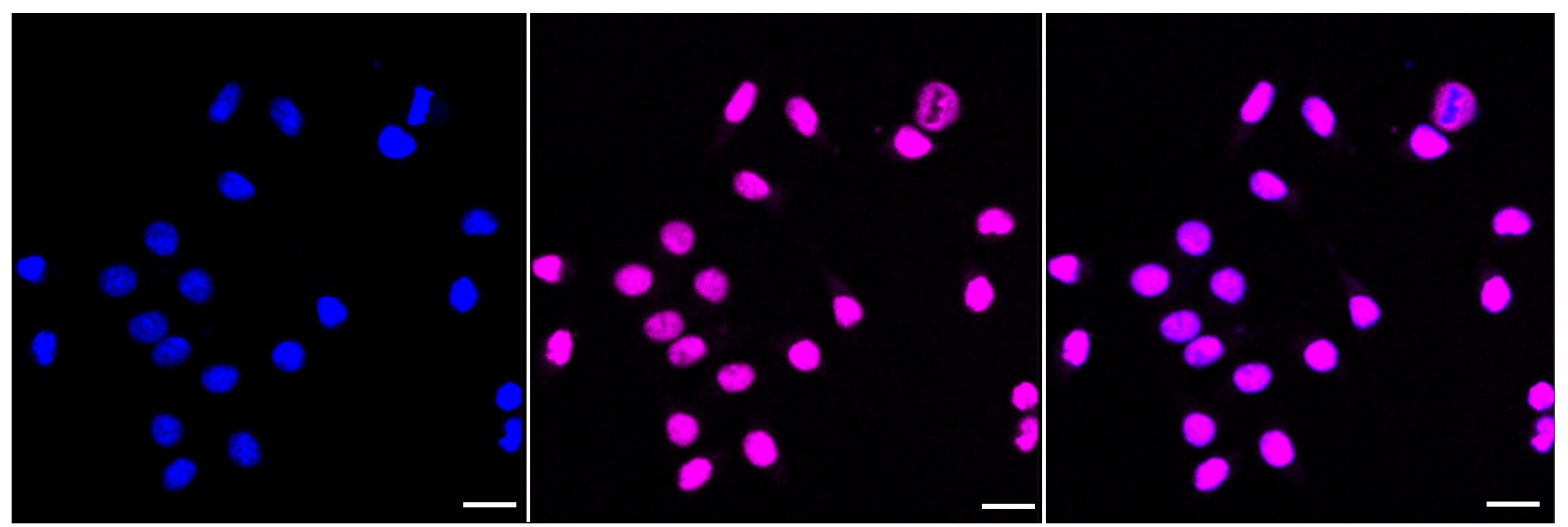 Chk2 Antibody (23GB3460)