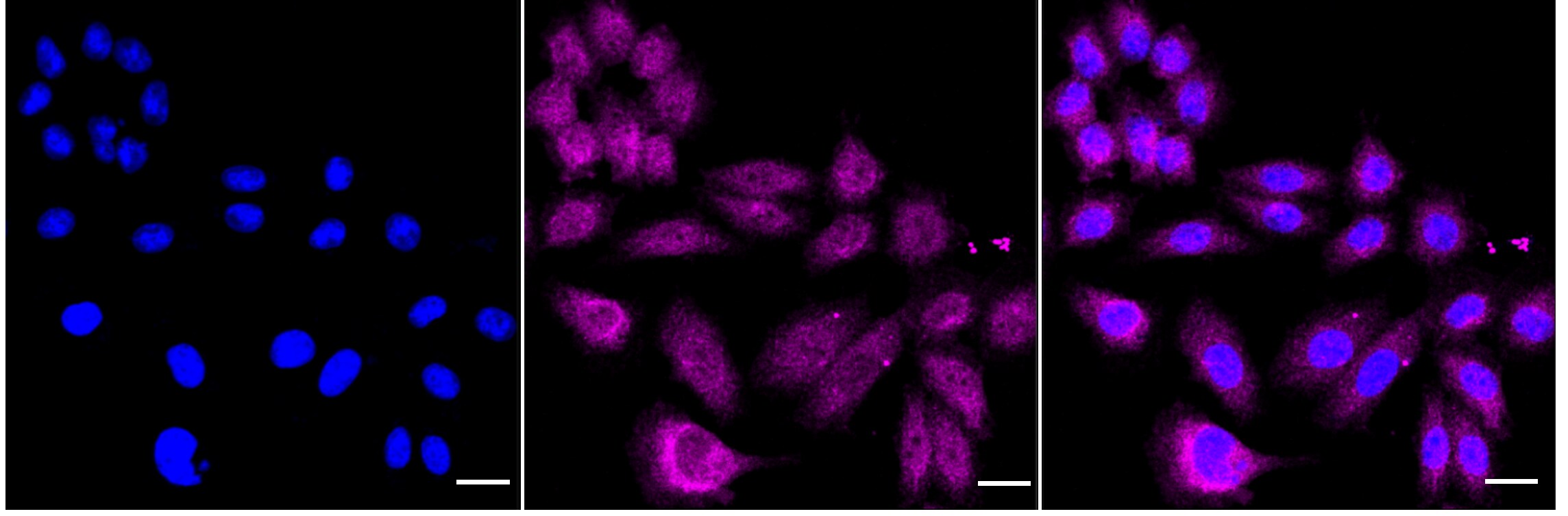 IKK alpha Antibody (23GB765)
