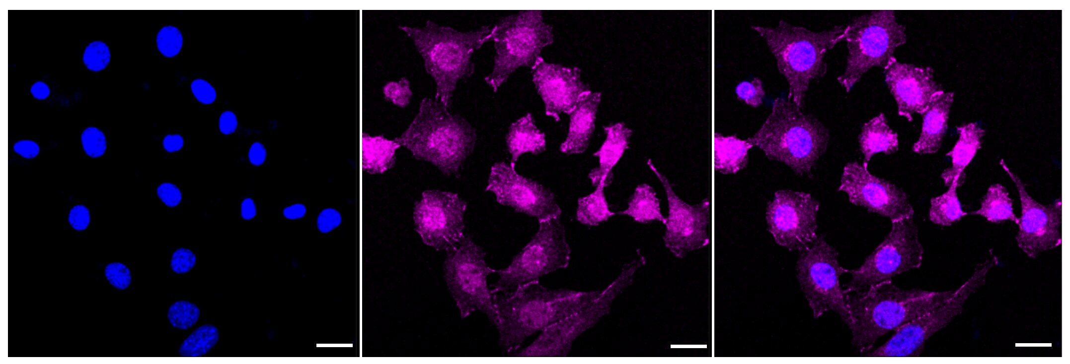 Catenin alpha 1 Antibody (23GB3335)