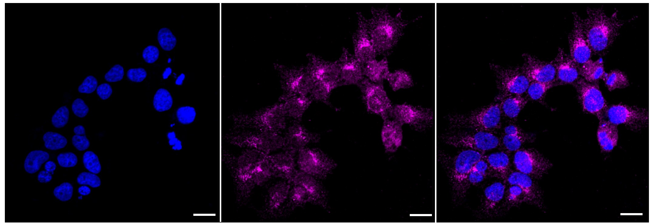 ATG9A Antibody (23GB3245)