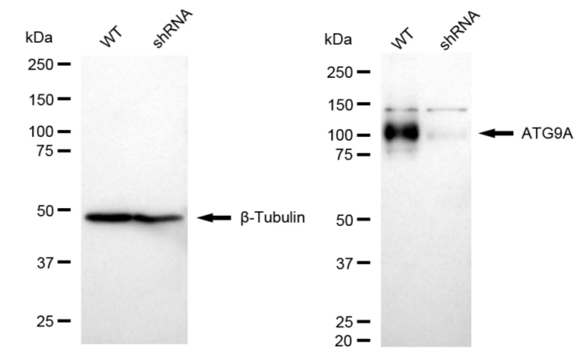 ATG9A Antibody (23GB3245)