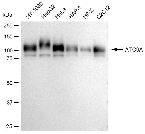 ATG9A Antibody (23GB3245)