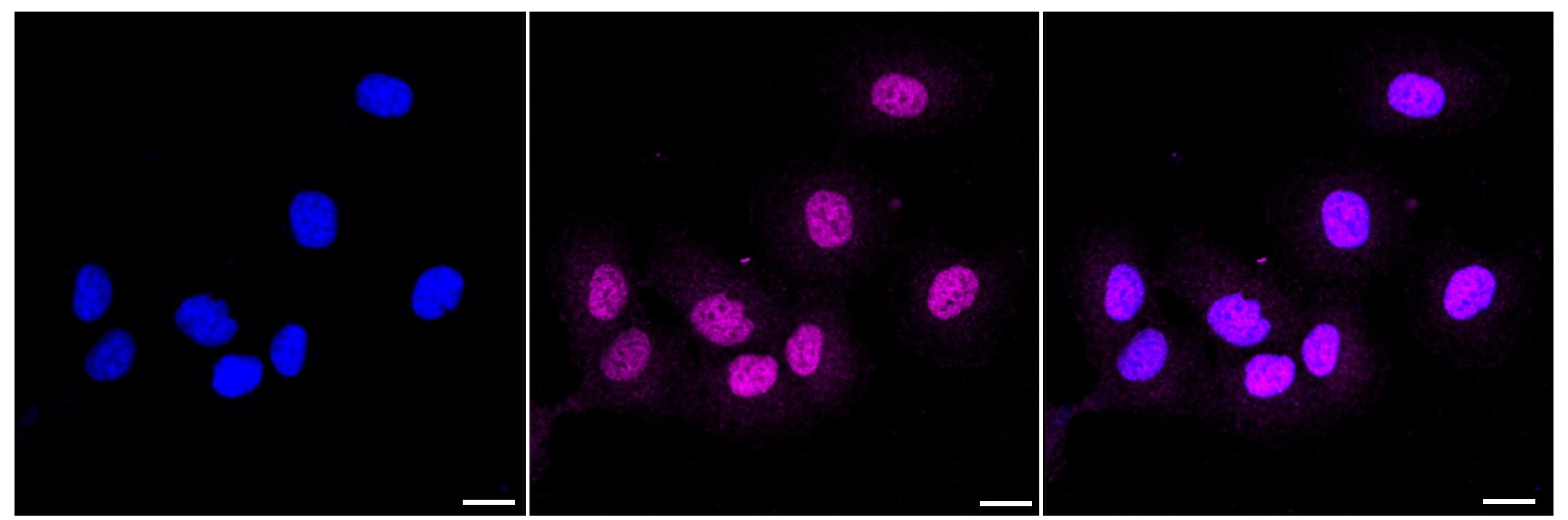Aminopeptidase N/CD13 Antibody (23GB3360)