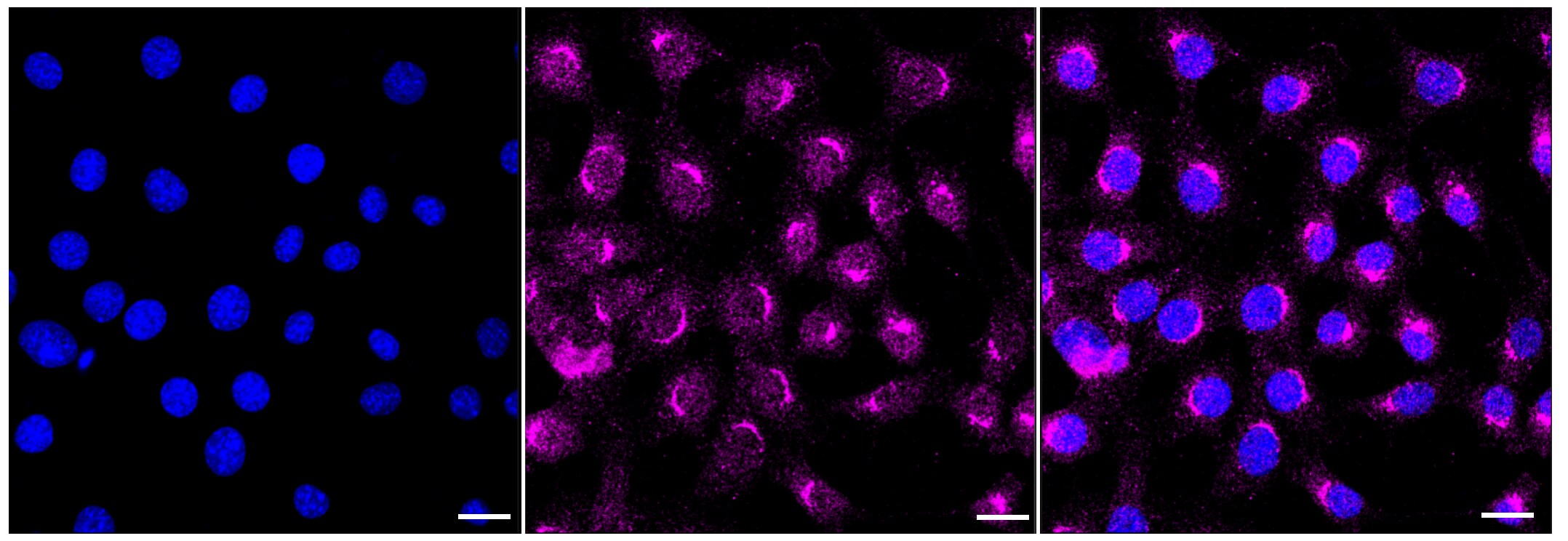 ARF1 Antibody (23GB3155)