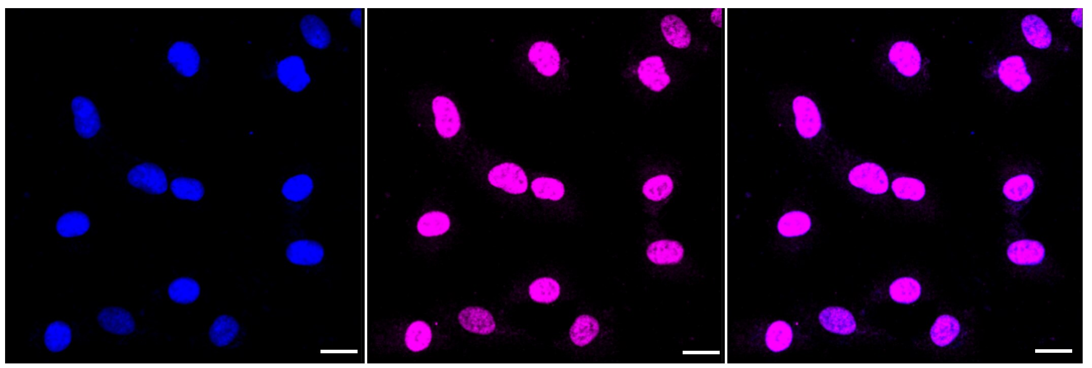ABCG2/CD338 Antibody (23GB3130)