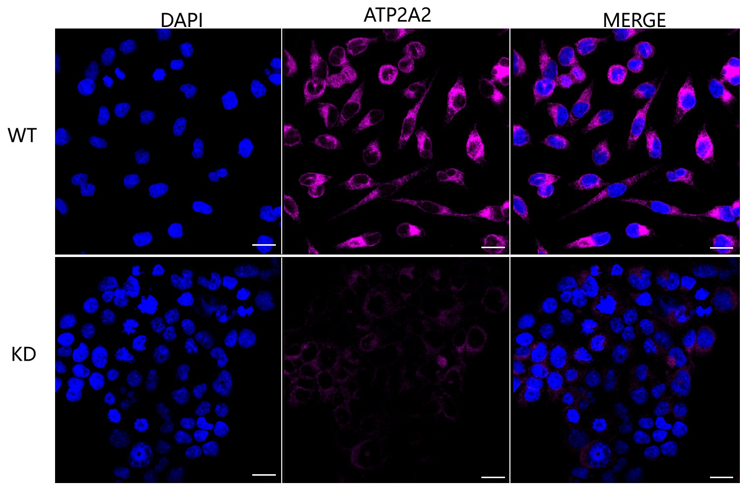 SERCA2 ATPase Antibody (23GB3250)