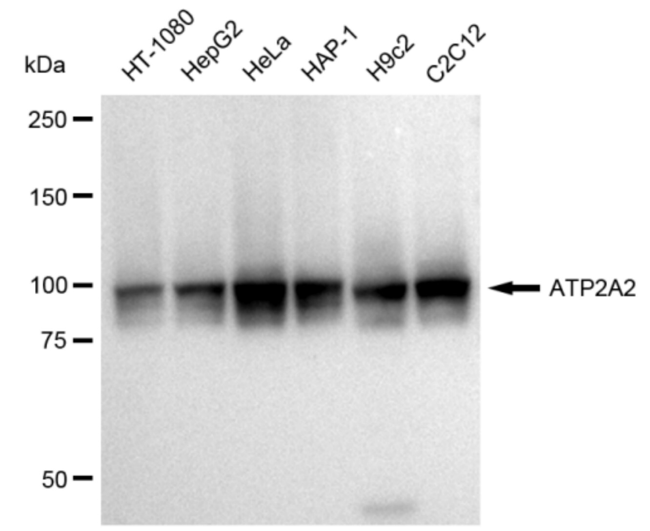 SERCA2 ATPase Antibody (23GB3250)