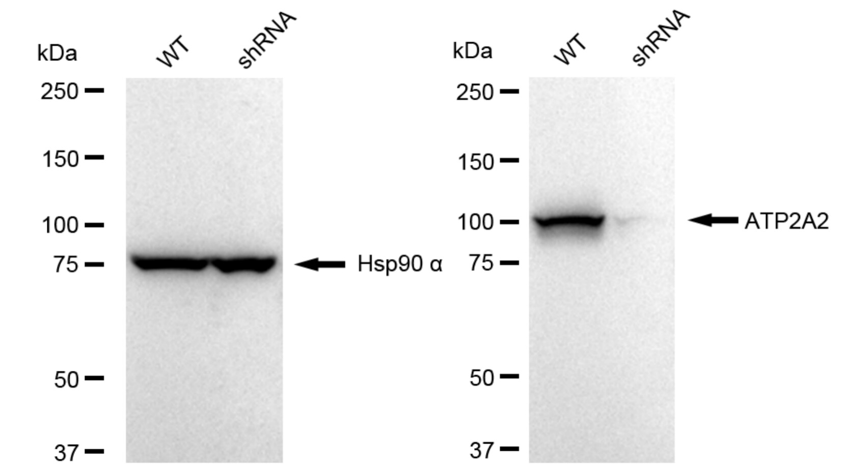 SERCA2 ATPase Antibody (23GB3250)