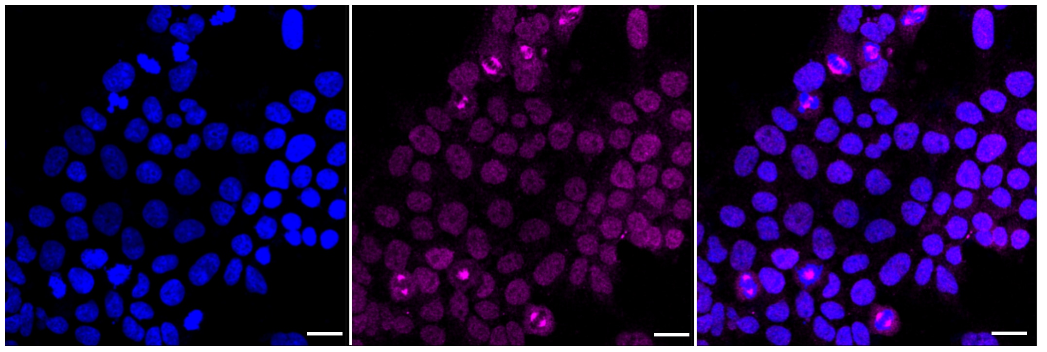 Carbonic Anhydrase II/CA2 Antibody (23GB3300)