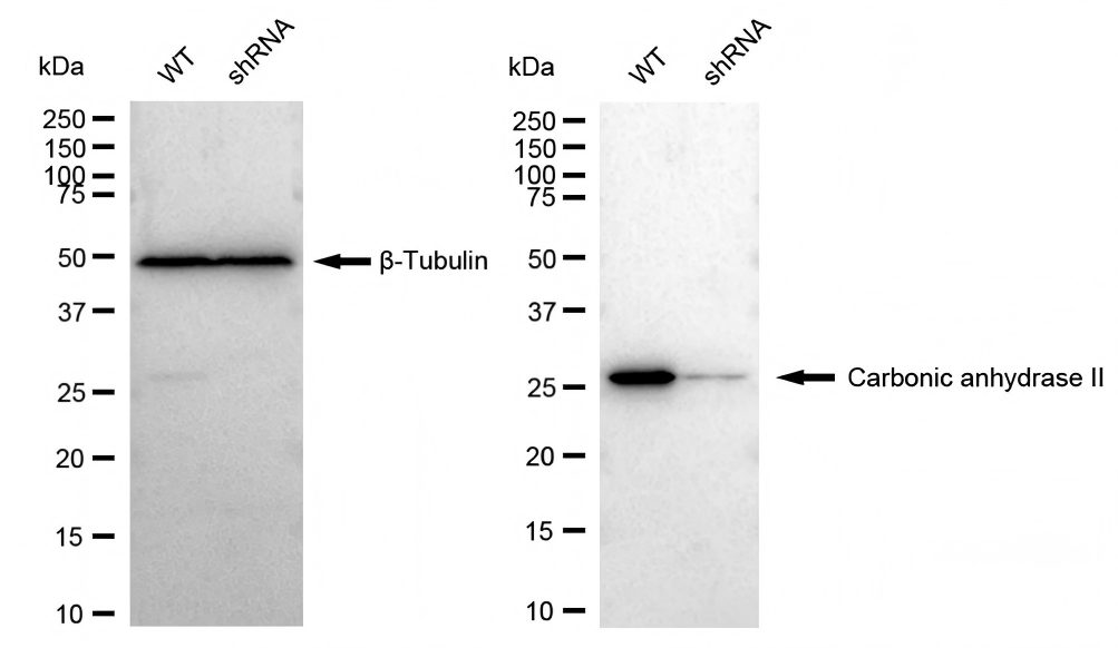 Carbonic Anhydrase II/CA2 Antibody (23GB3300)