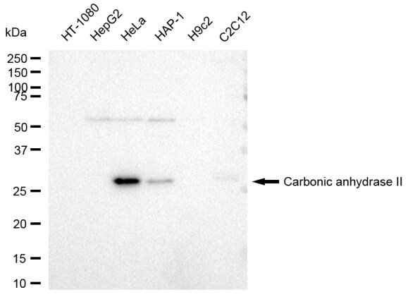 Carbonic Anhydrase II/CA2 Antibody (23GB3300)