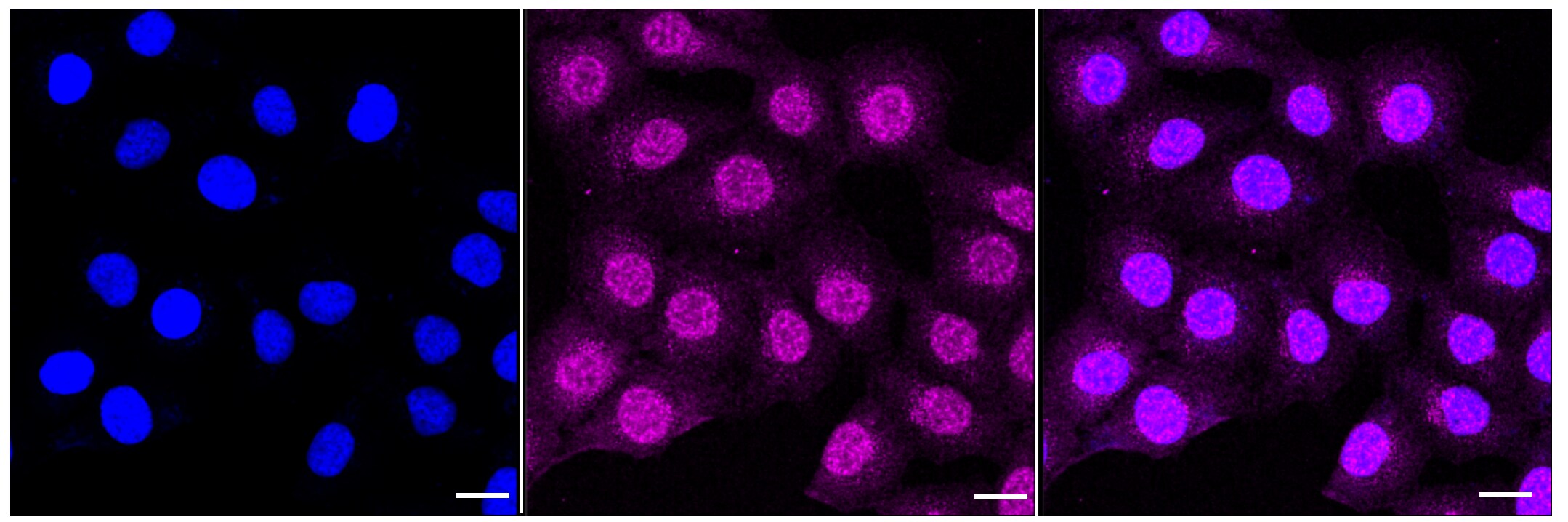 Calpain 2 Antibody (23GB3295)