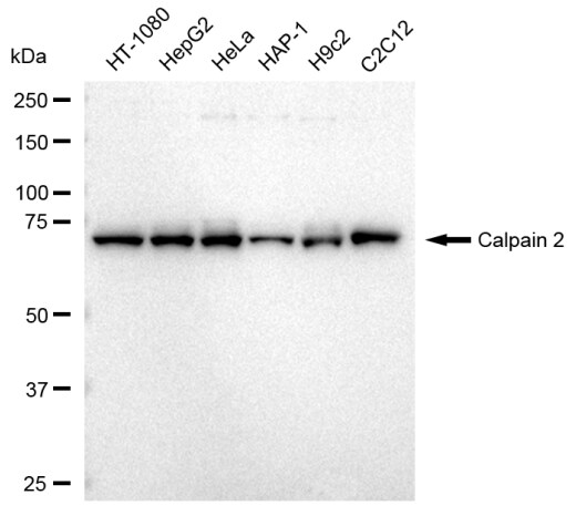 Calpain 2 Antibody (23GB3295)
