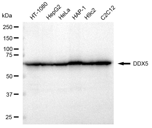 DDX5 Antibody (23GB3550)