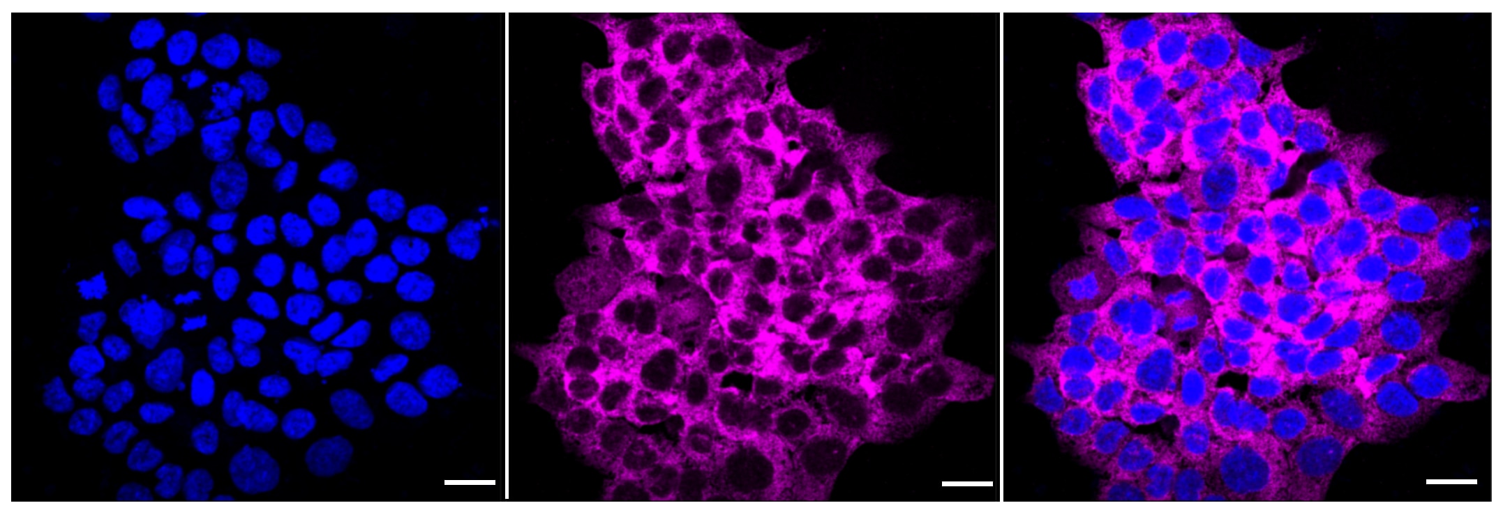 CLIC4 Antibody (23GB3465)