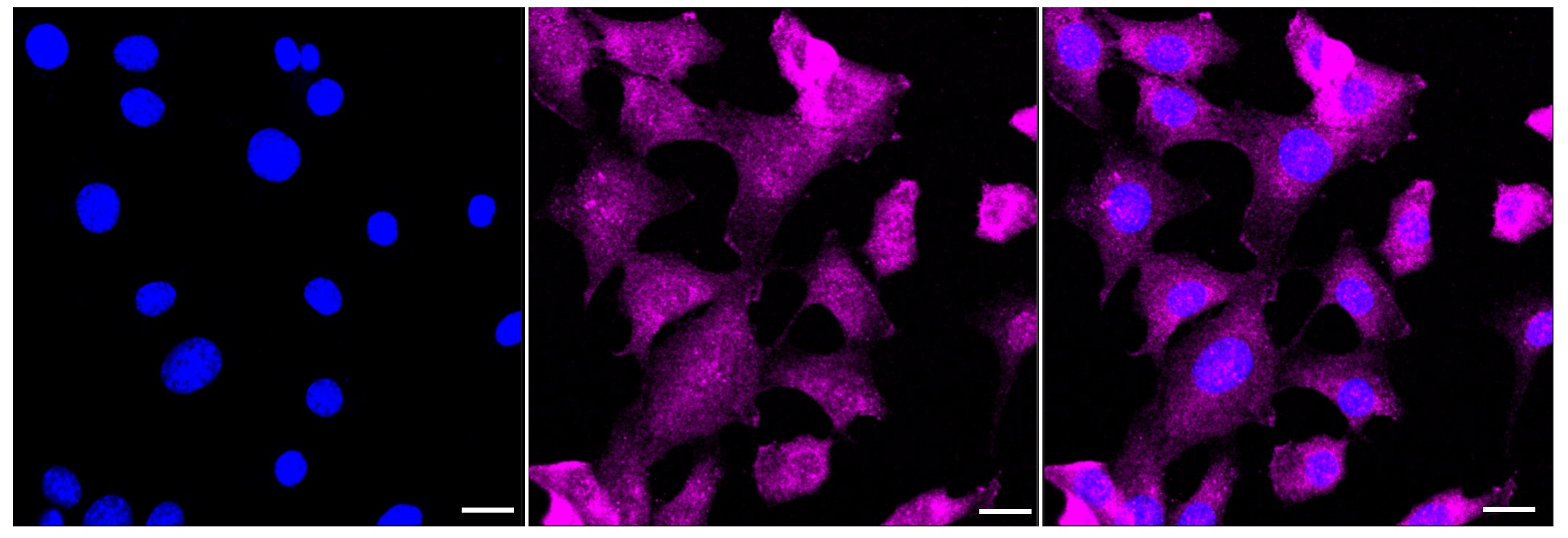 CSDE1 Antibody (23GB3510)