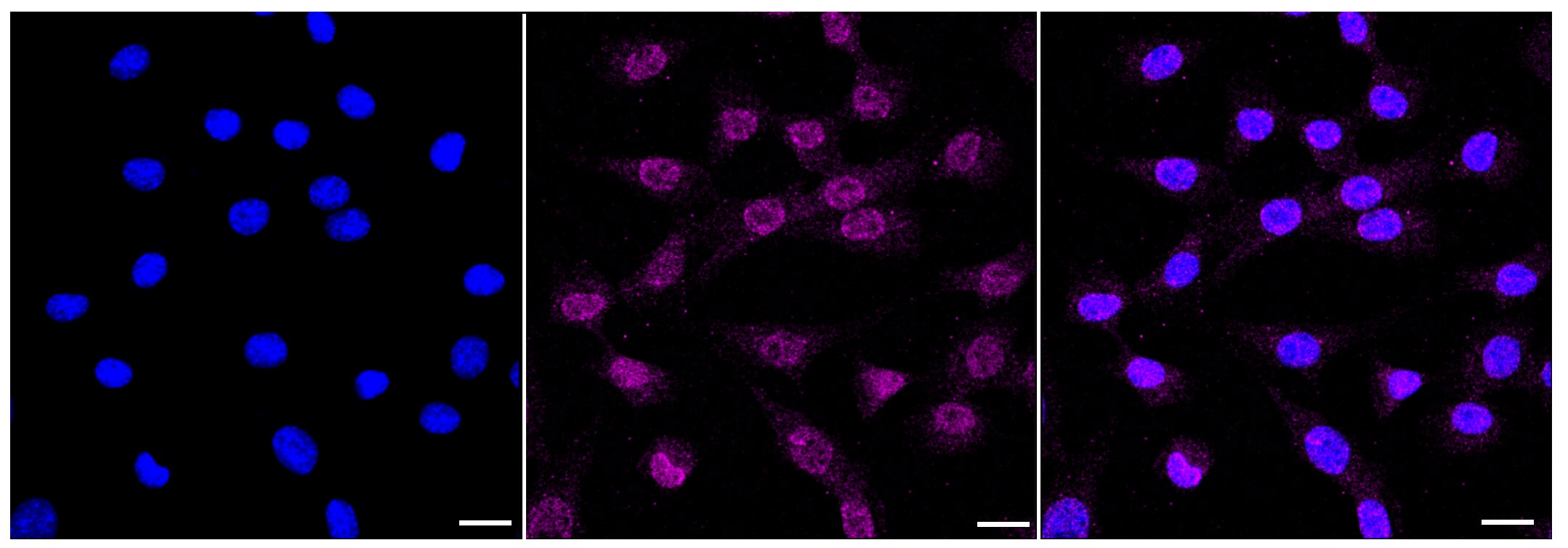 CDC73/HRPT2 Antibody (23GB3450)