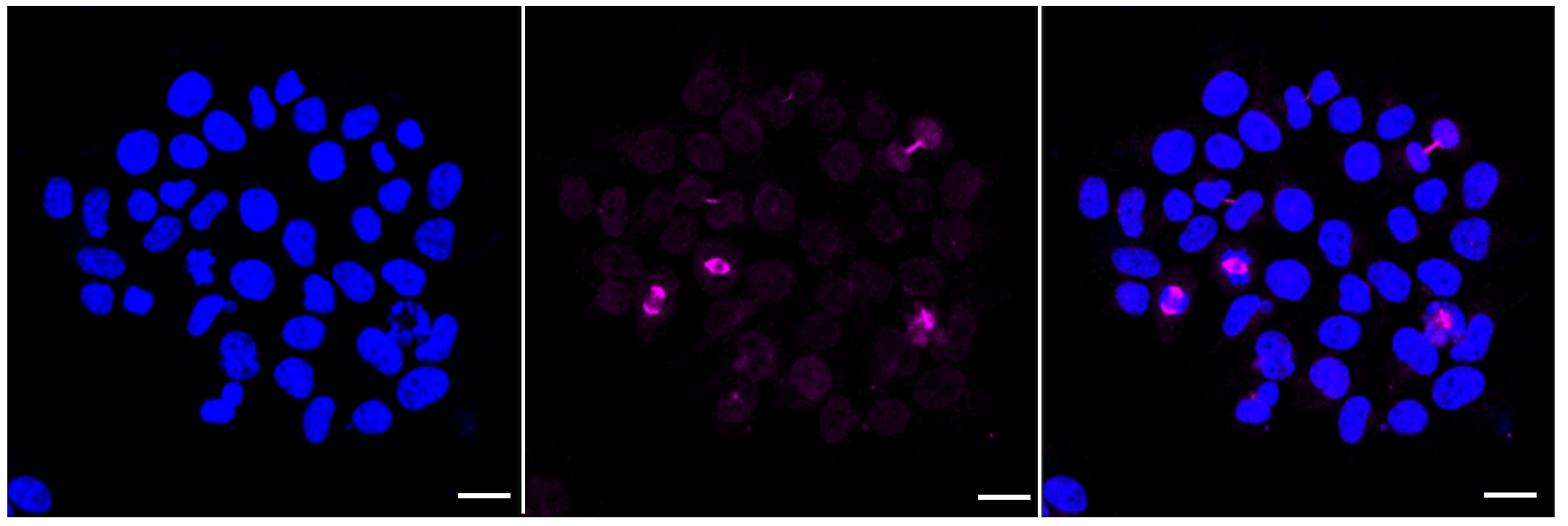 CSE1L/CAS/Exportin-2 Antibody (23GB3515)