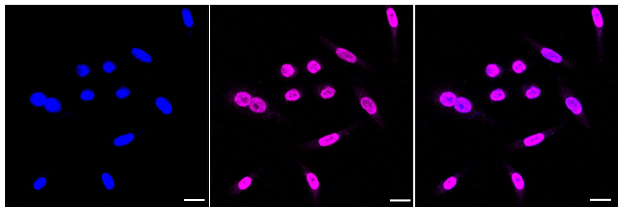 Alkaline Phosphatase, Intestinal Antibody (23GB3645)