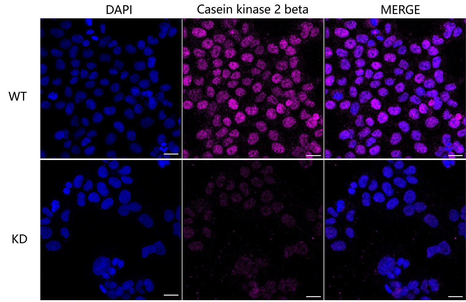 Casein Kinase 2 beta Antibody (23GB3730)
