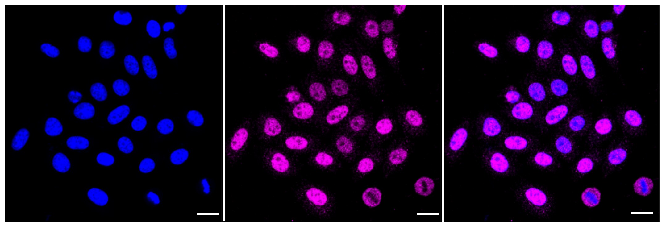 Casein Kinase 2 beta Antibody (23GB3730)
