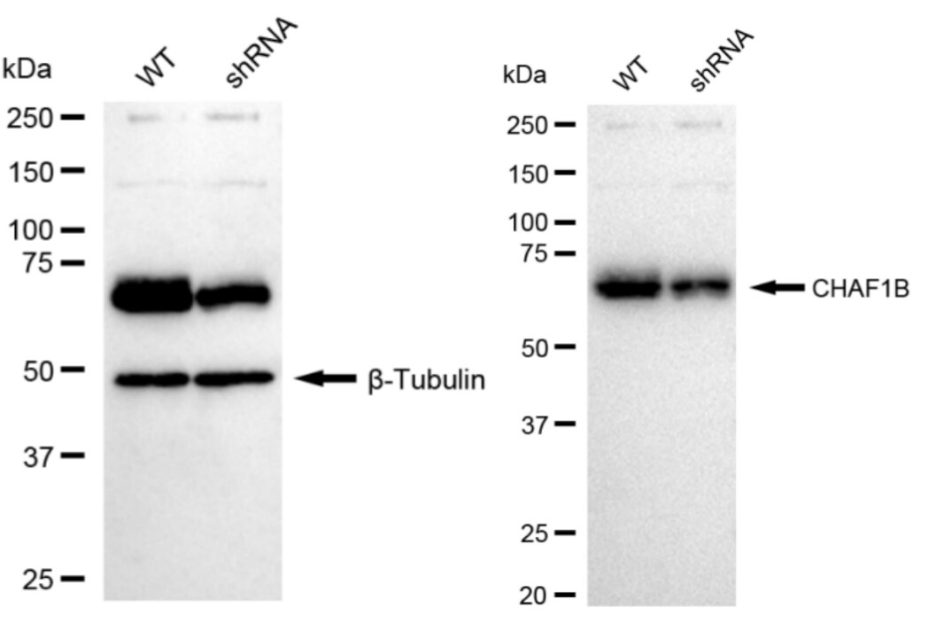 CHAF1B Antibody (23GB3765)