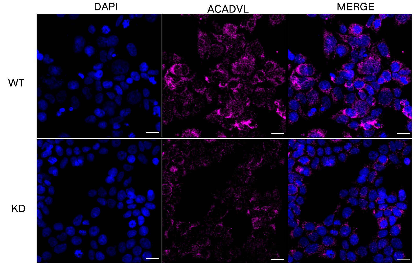 ACADVL Antibody (23GB3615)
