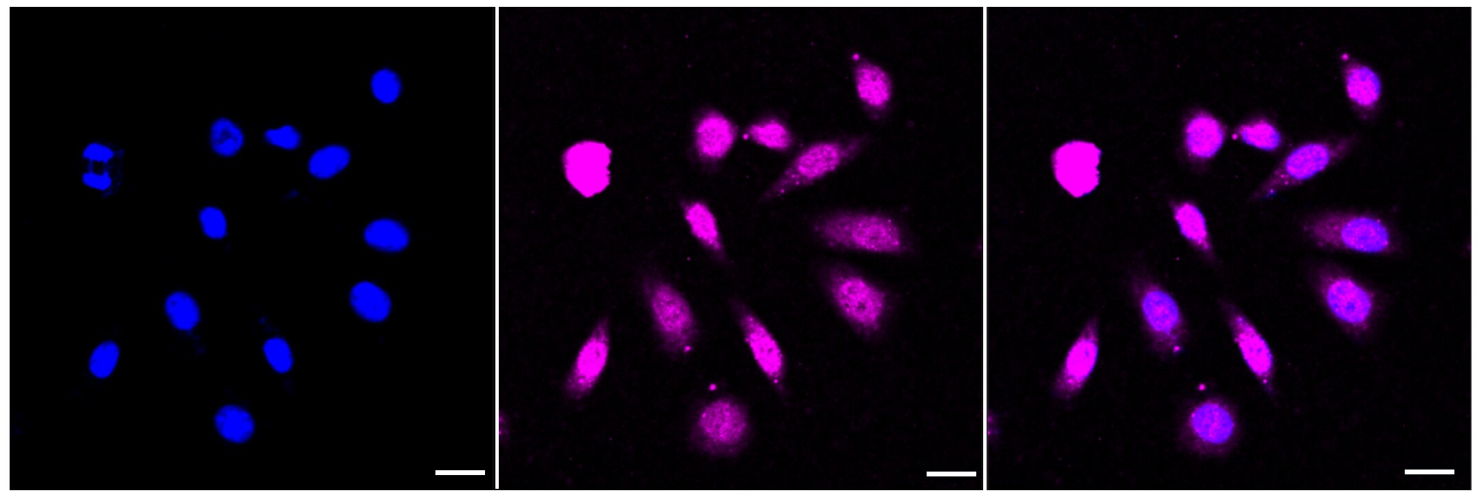 ACADVL Antibody (23GB3615)