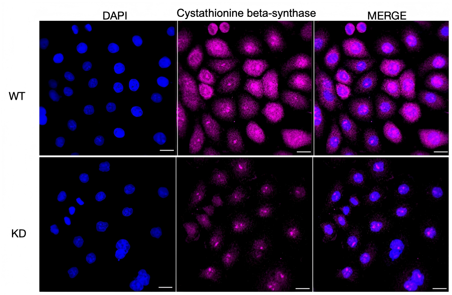 CBS Antibody (23GB3800)