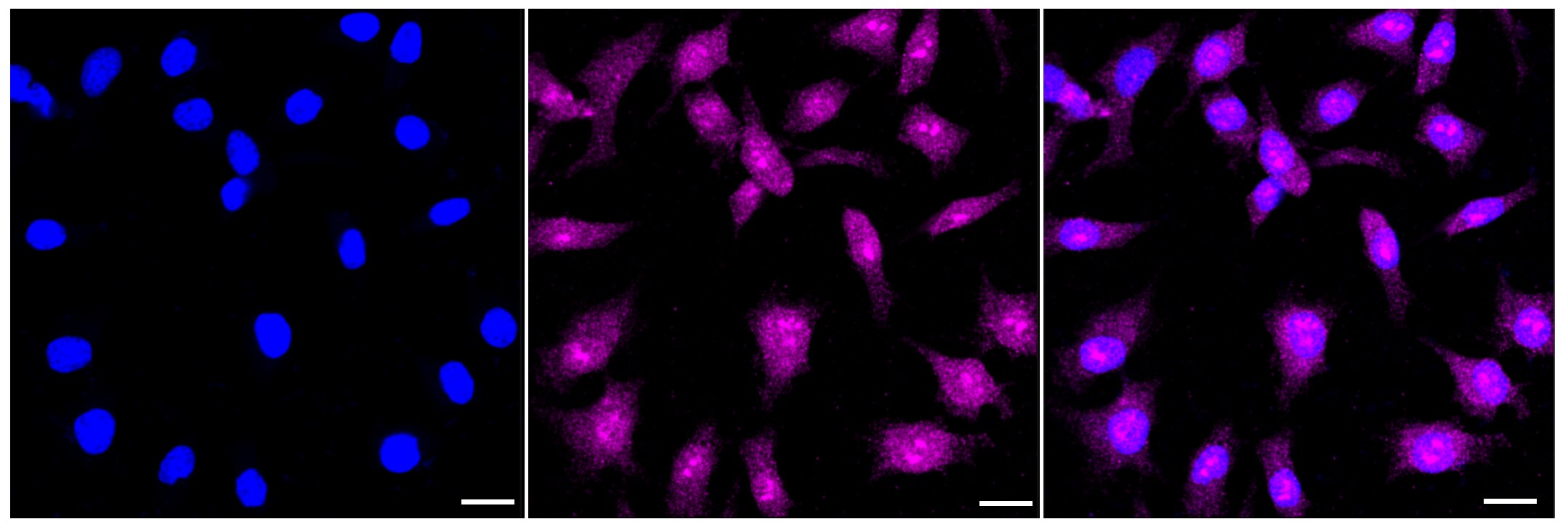 CBS Antibody (23GB3800)