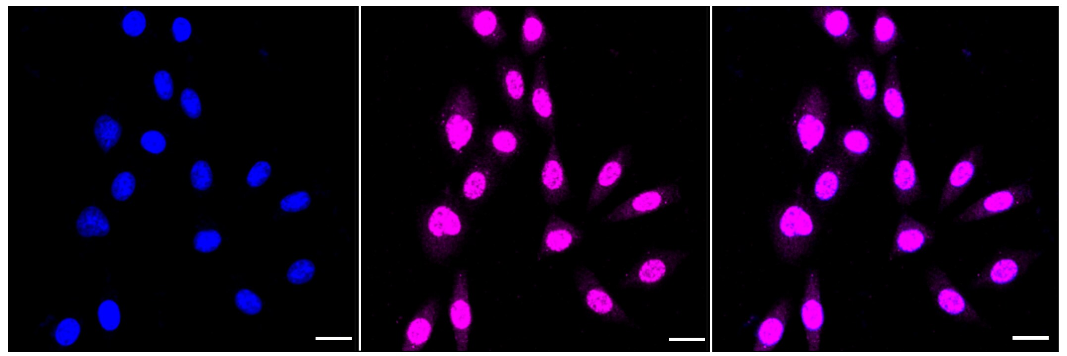 Calpain S1 Antibody (23GB3720)