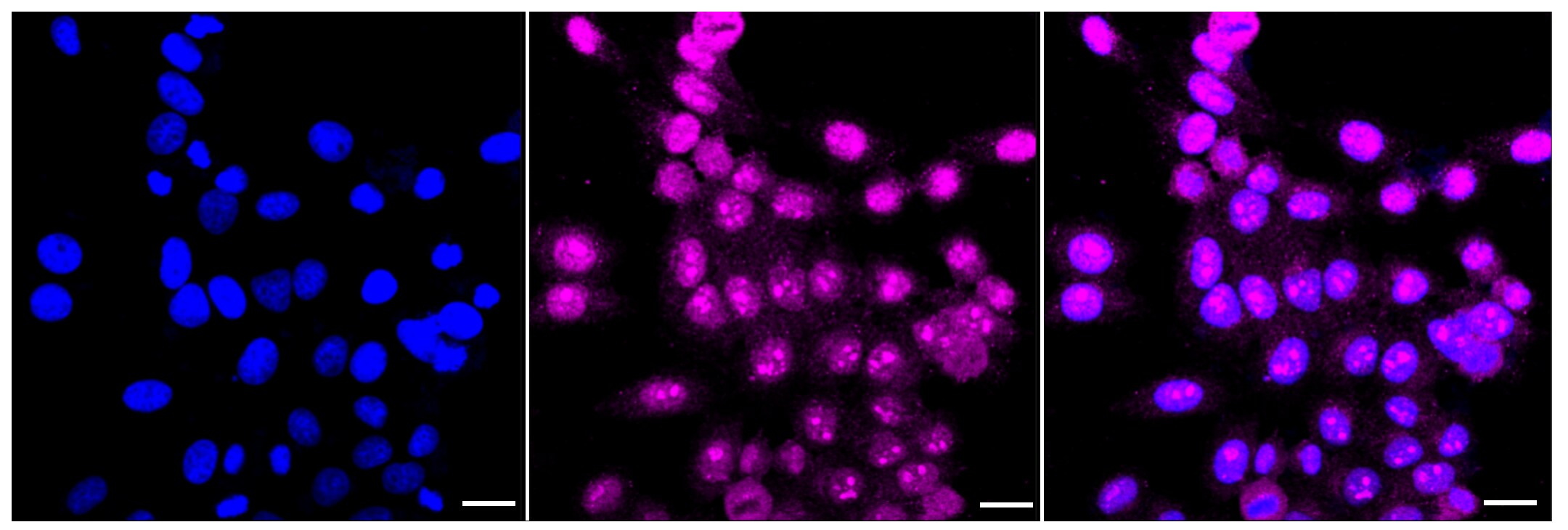 ARF5 Antibody (23GB3635)