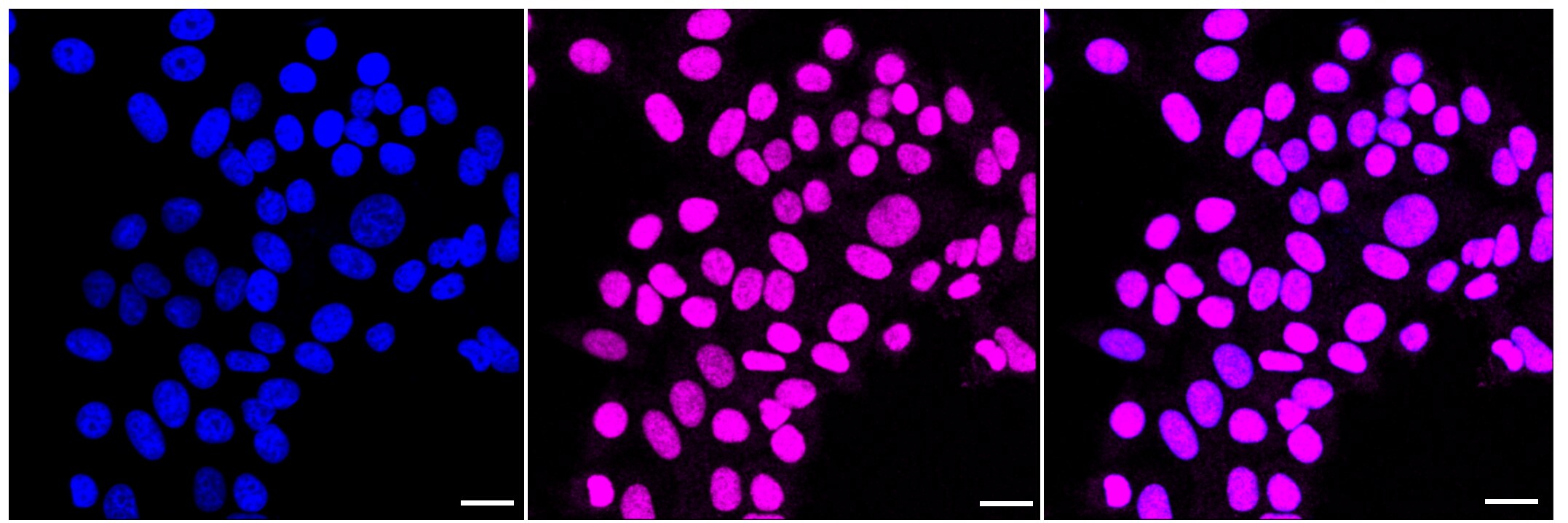HLTF Antibody (23GB2485)