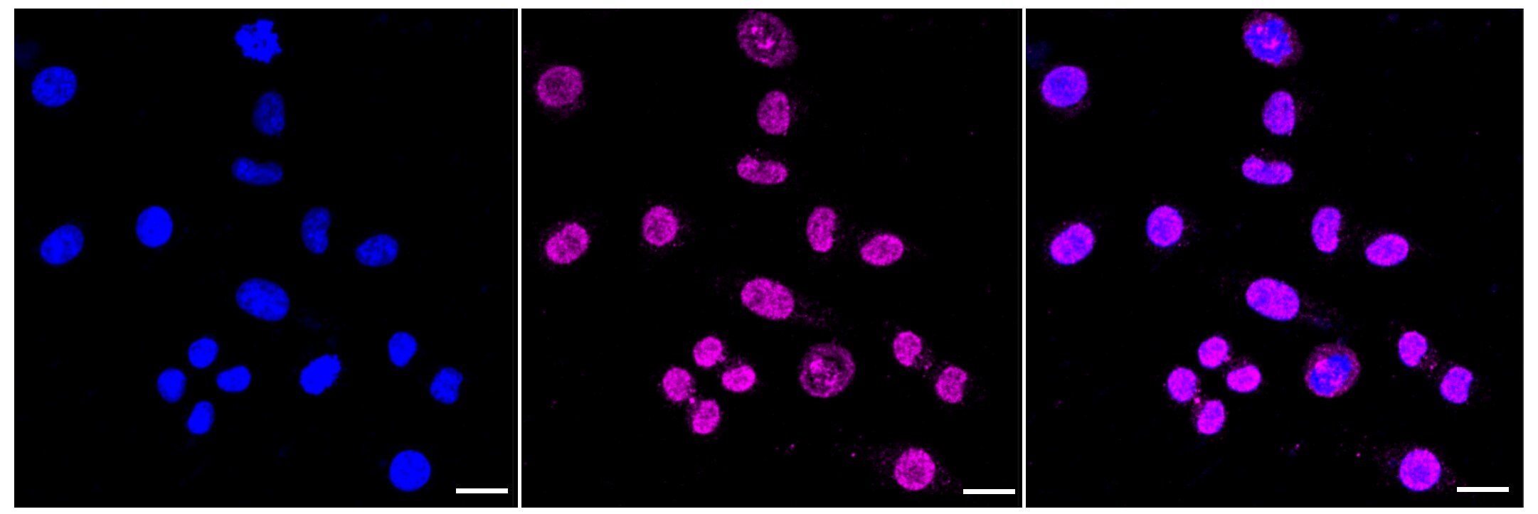 HSF1 Antibody (23GB2715)
