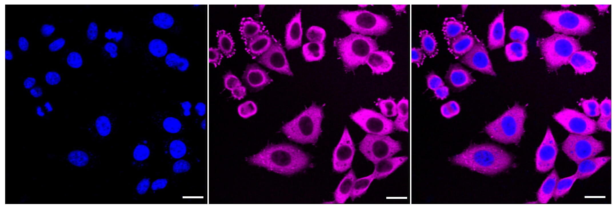 HSP90 beta Antibody (23GB2785)