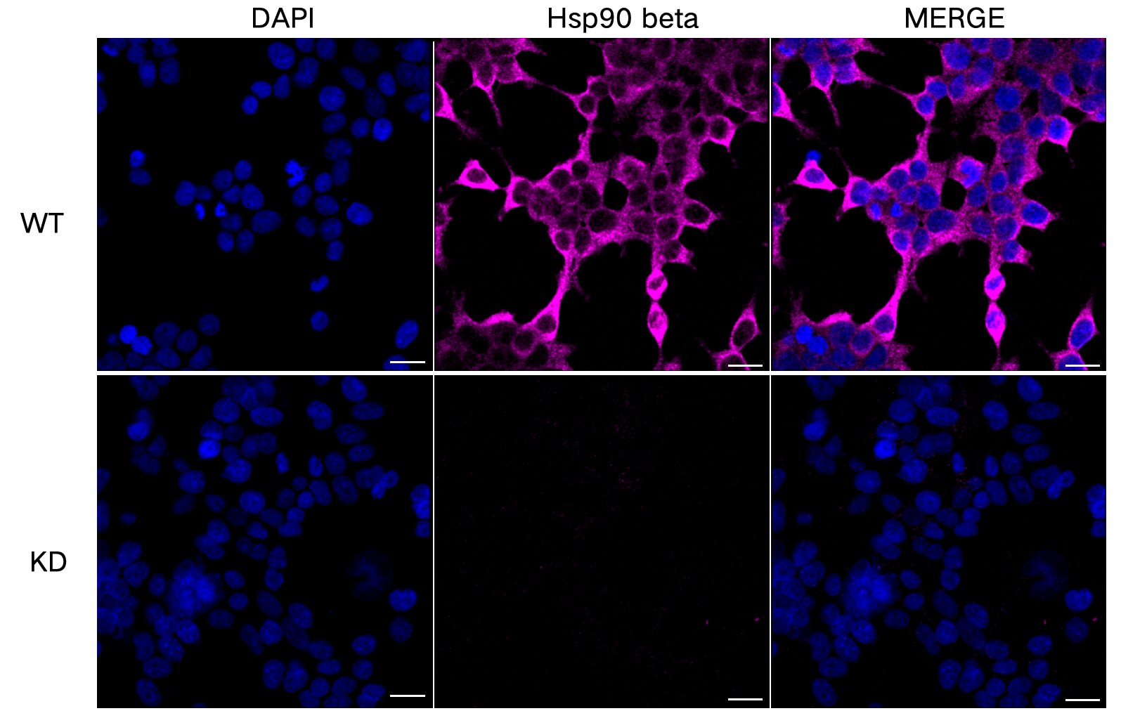 HSP90 beta Antibody (23GB2770)