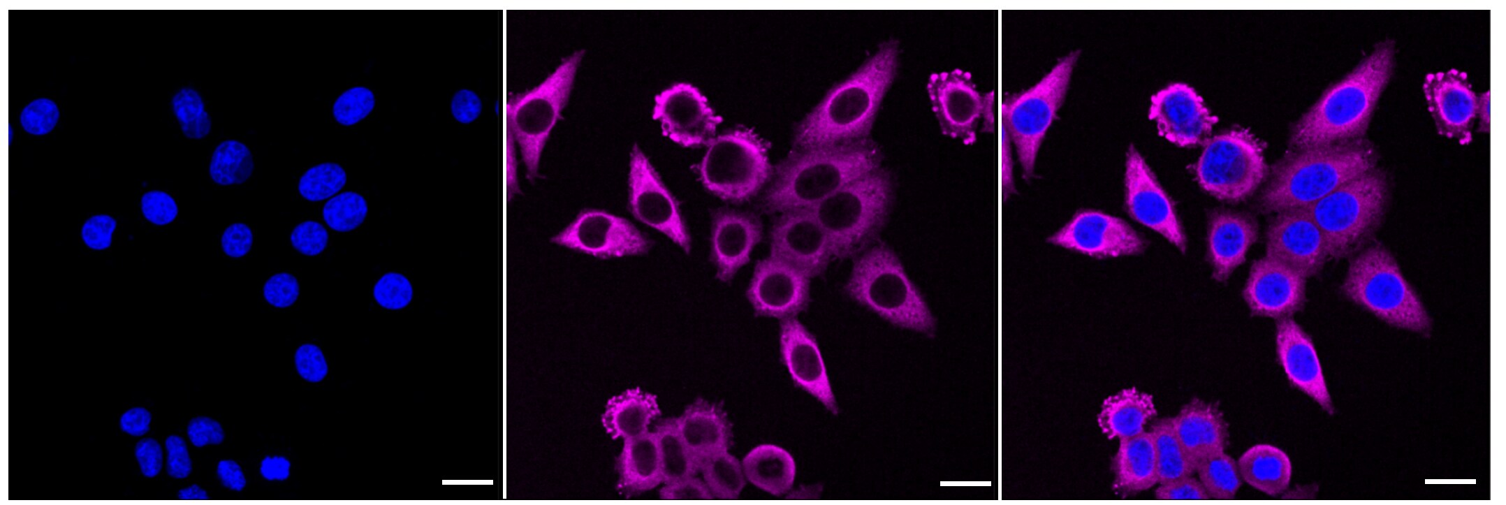 HSP90 beta Antibody (23GB2770)