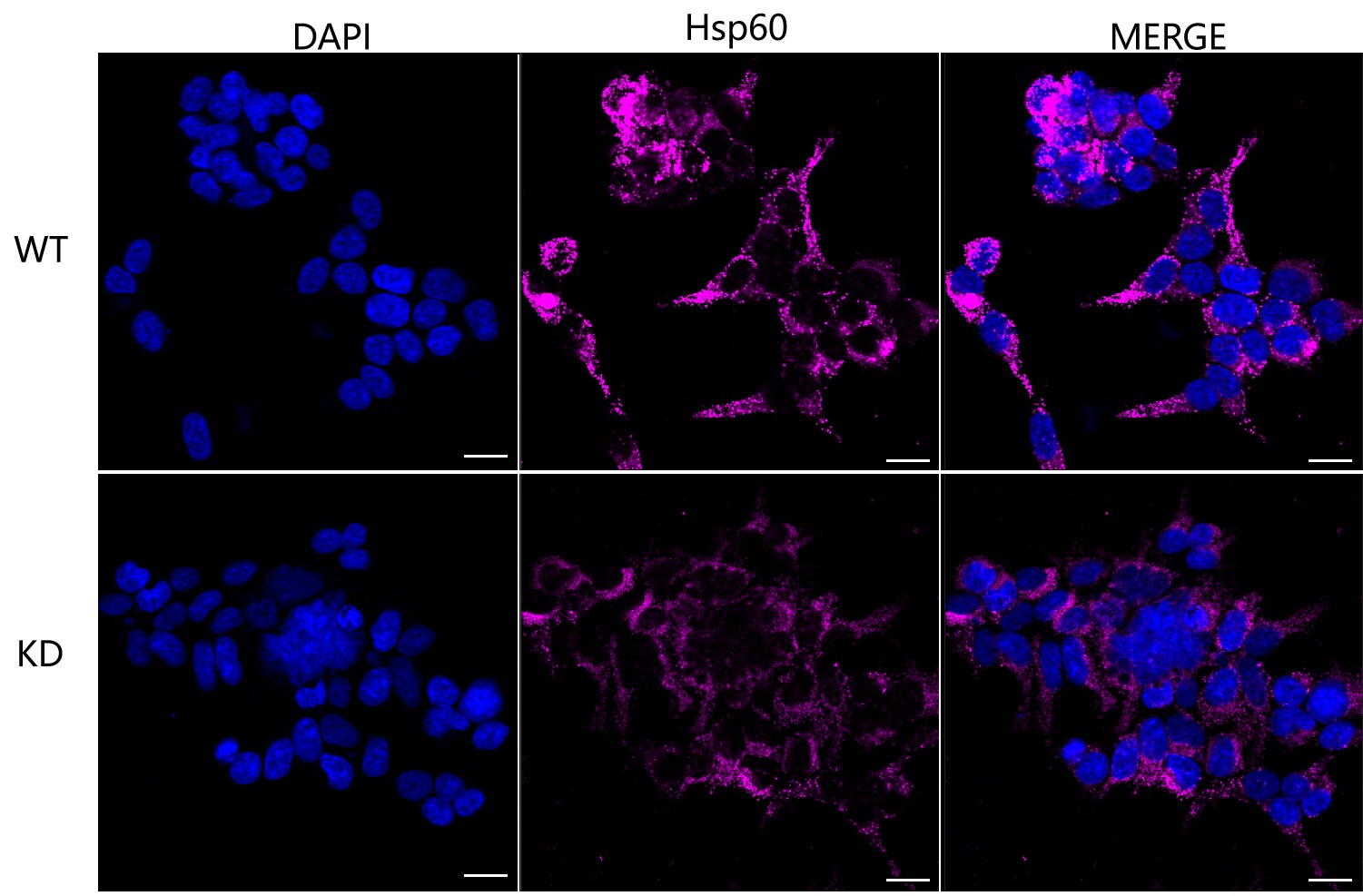 HSP60 Antibody (23GB2680)
