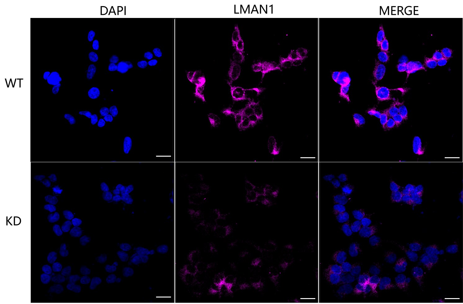LMAN1 Antibody (23GB2835)