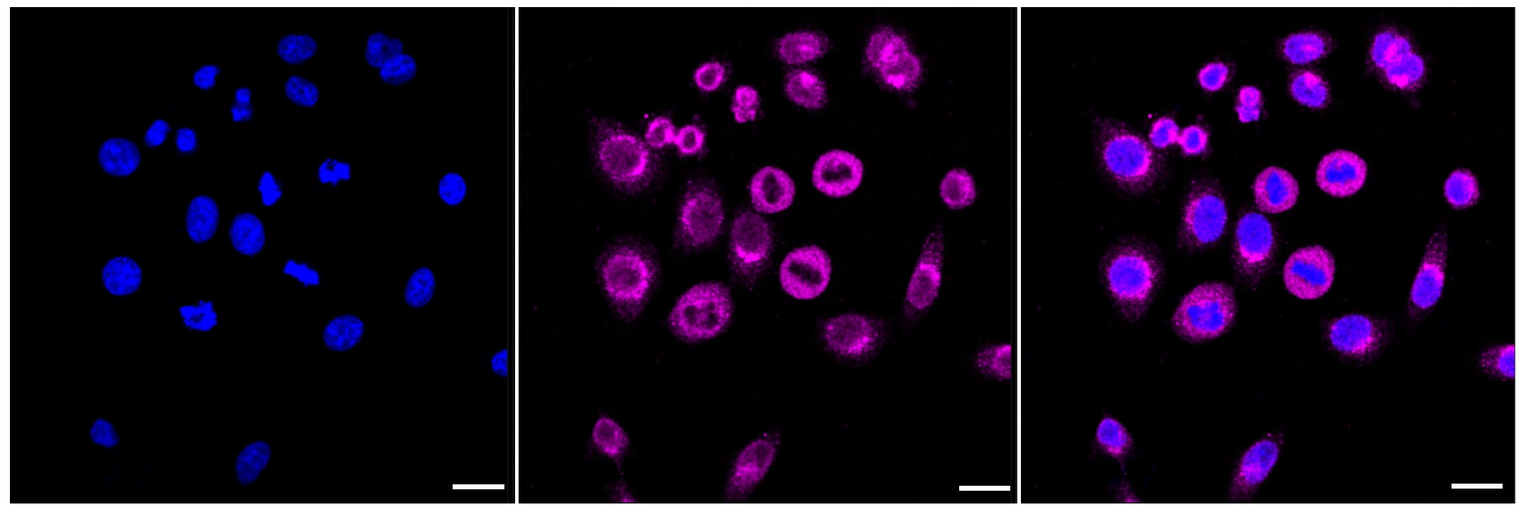 LMAN1 Antibody (23GB2835)